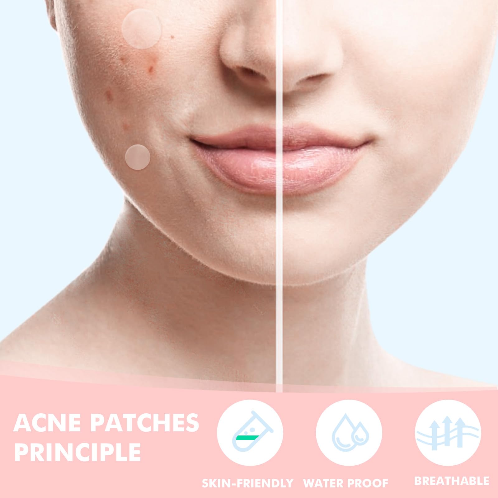 Pimple Patches for Face 304pcs,Hydrocolloid Acne Patches Star,Zit Patches,Pimple Popper Tool Kit,Facial Skin Care Products Containing Salicylic Acid,Tea Tree Oil and Calendula Oil(304)